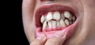 child Dentistry in Kolkata